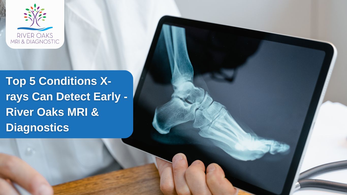 Top 5 Conditions X-rays Can Detect Early – River Oaks MRI & Diagnostics